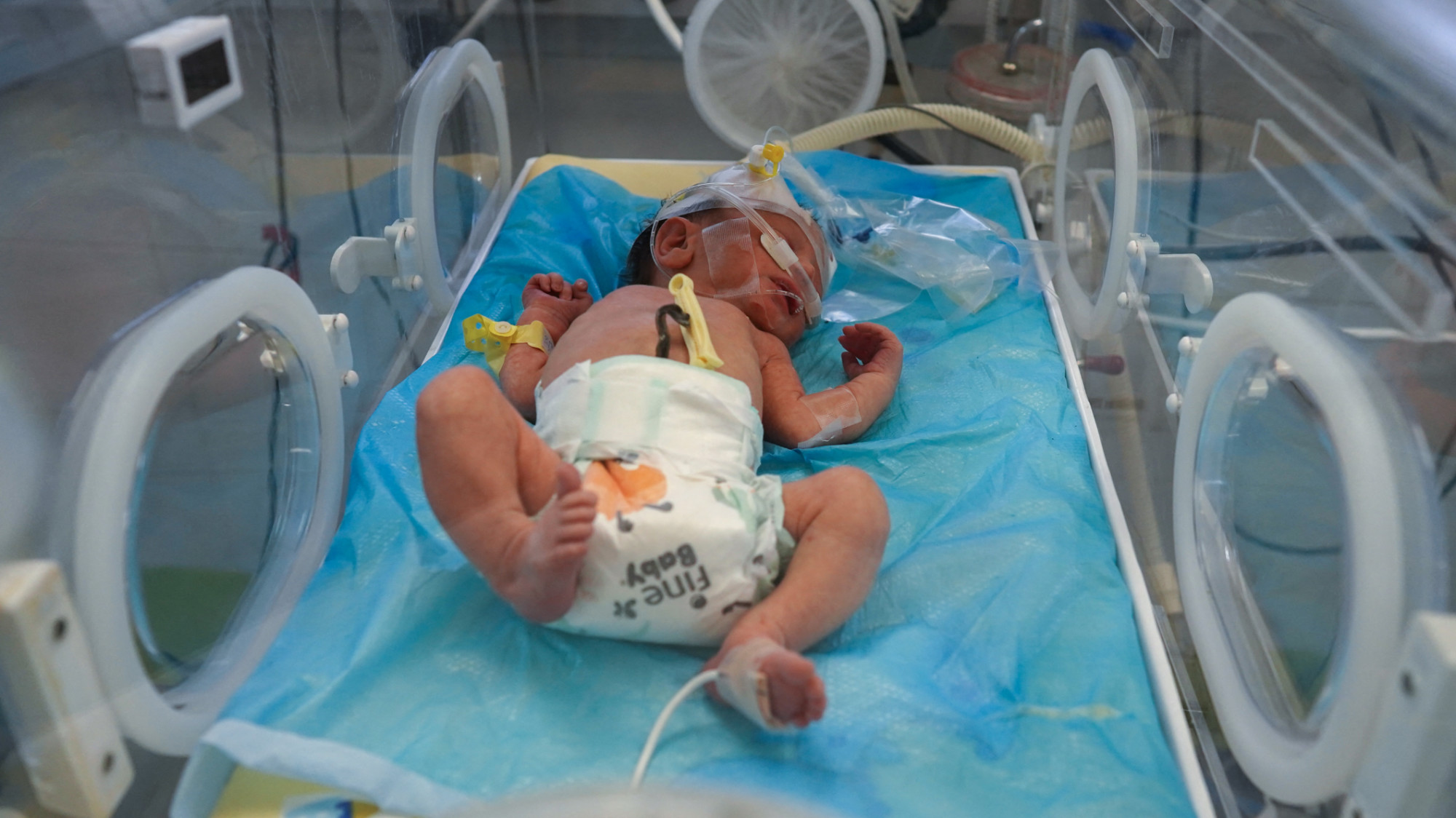 A Palestinian premature baby receives care in an incubator at Khan Yunis's Nasser hopsital, whose administration said their lives were at risk as the fuel stock dwindles (AFP)