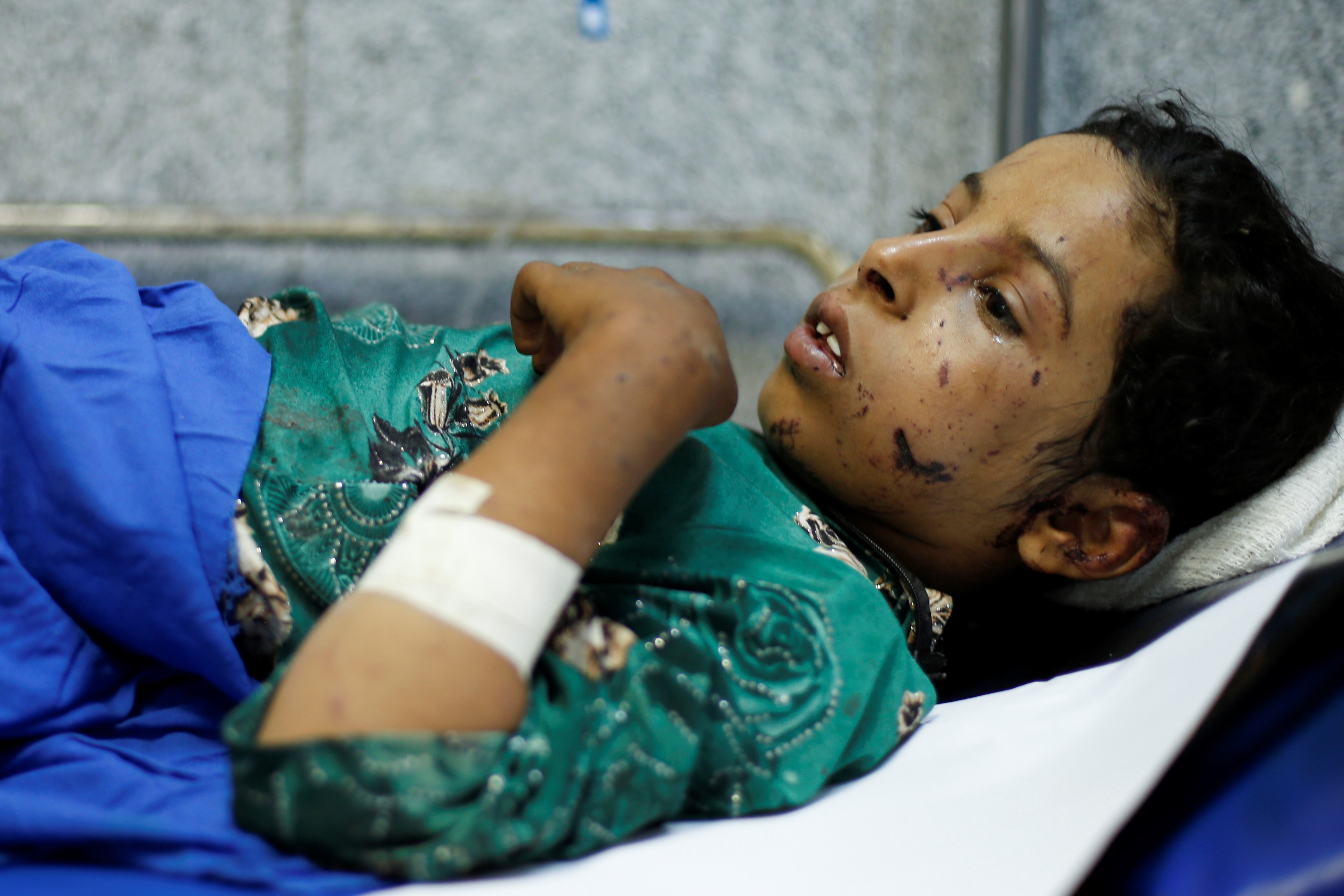 Qaboul Mabkhout Marzouq, 11, lies on a stretcher at a hospital in Sanaa after she was injured in an air strike in the northern province of al-Jawf, Yemen on 15 July, 2020 (Reuters)