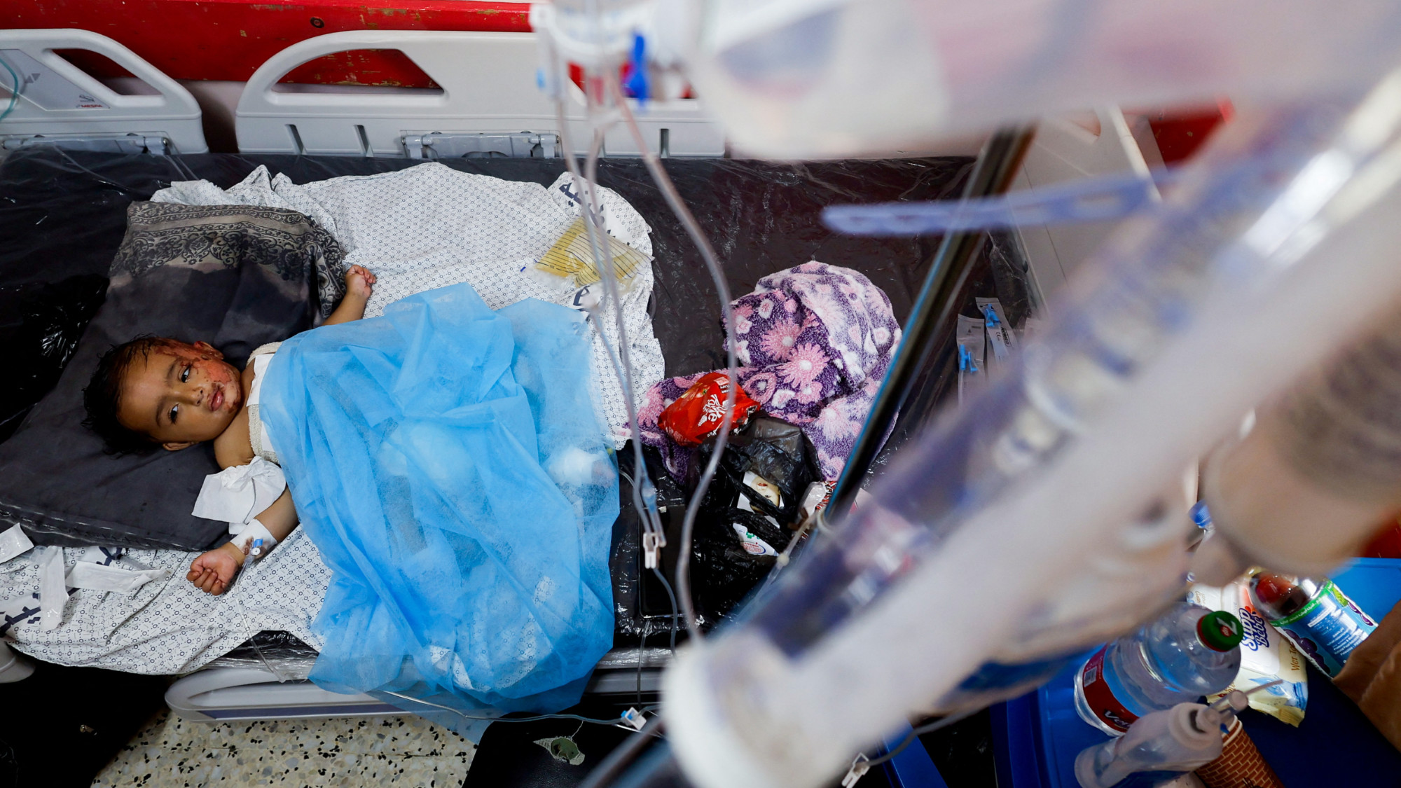 A 14-months-old Palestinian wounded in an Israeli strike rests at Nasser hospital, in Khan Younis, in the southern Gaza Strip, 23 October 2023 (Reuters)