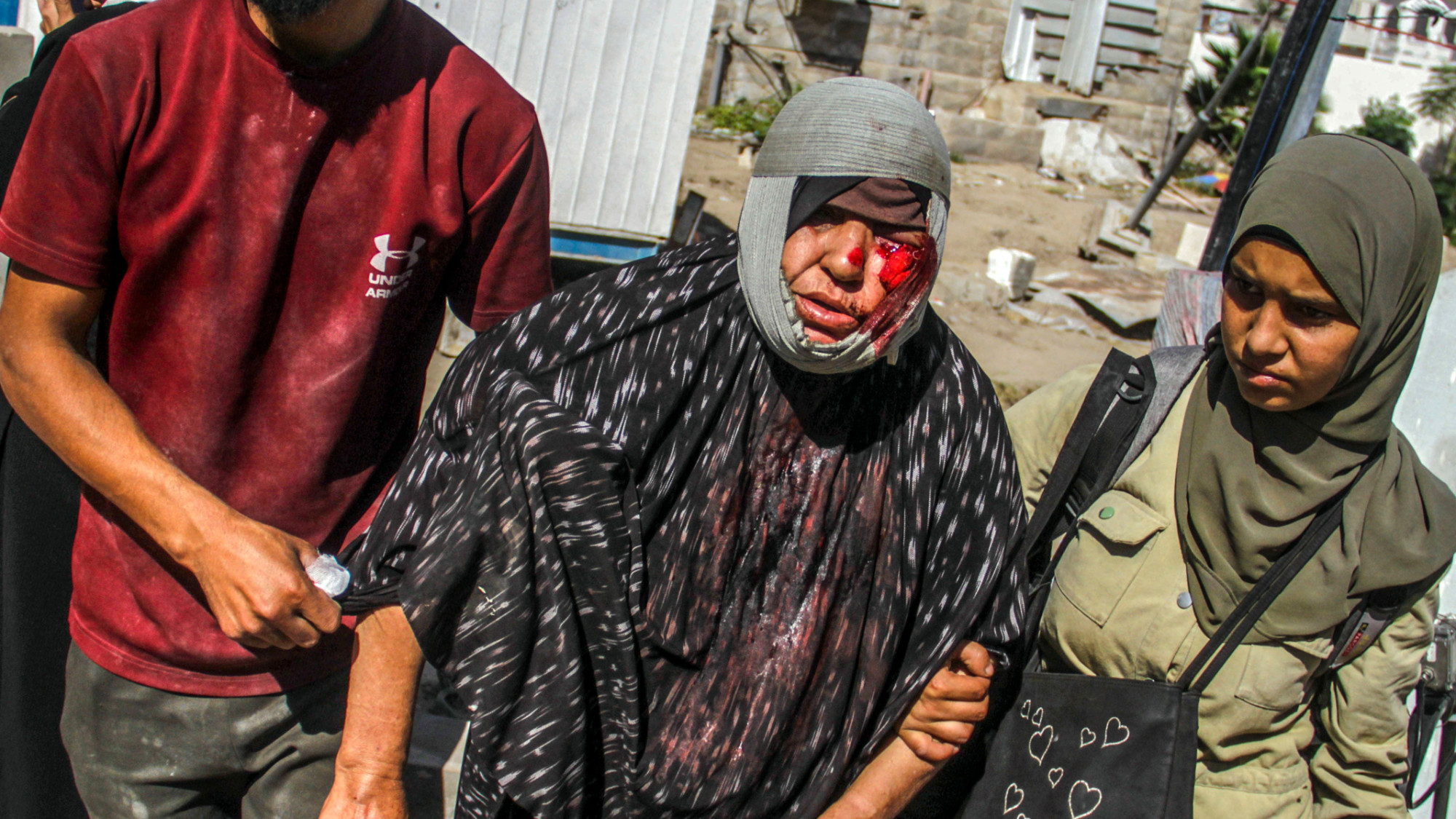 Palestinians hold a woman wounded in an Israeli airstrike on Jabalia as she is transported Gaza City  21 October 2024 (IMAGO/PIN via Reuters)