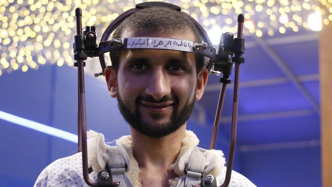 Ahmed Jaber has been forced to wear a device to hold his head and chest in place and prevent his neck from injury after the tuberculosis spread to his bones (Bird)