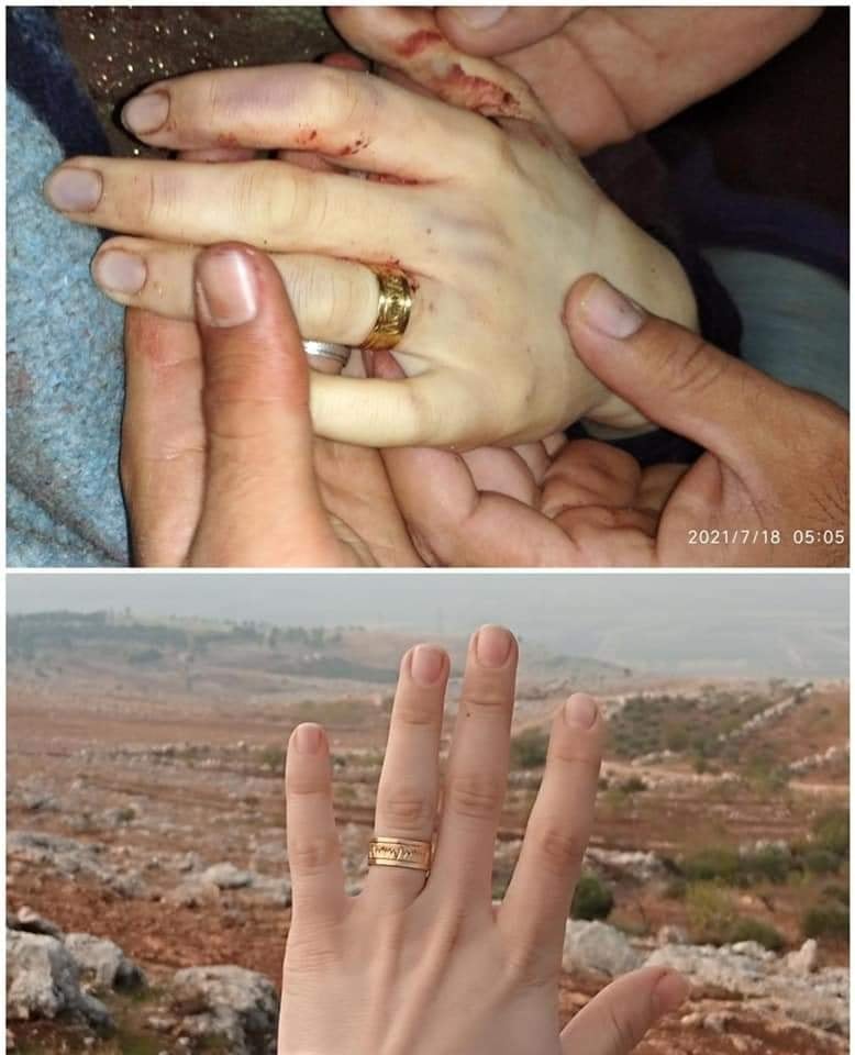 Barakat posted a picture of her wedding ring on social media. Above, the same ring can be seen on her corpse (MEE)