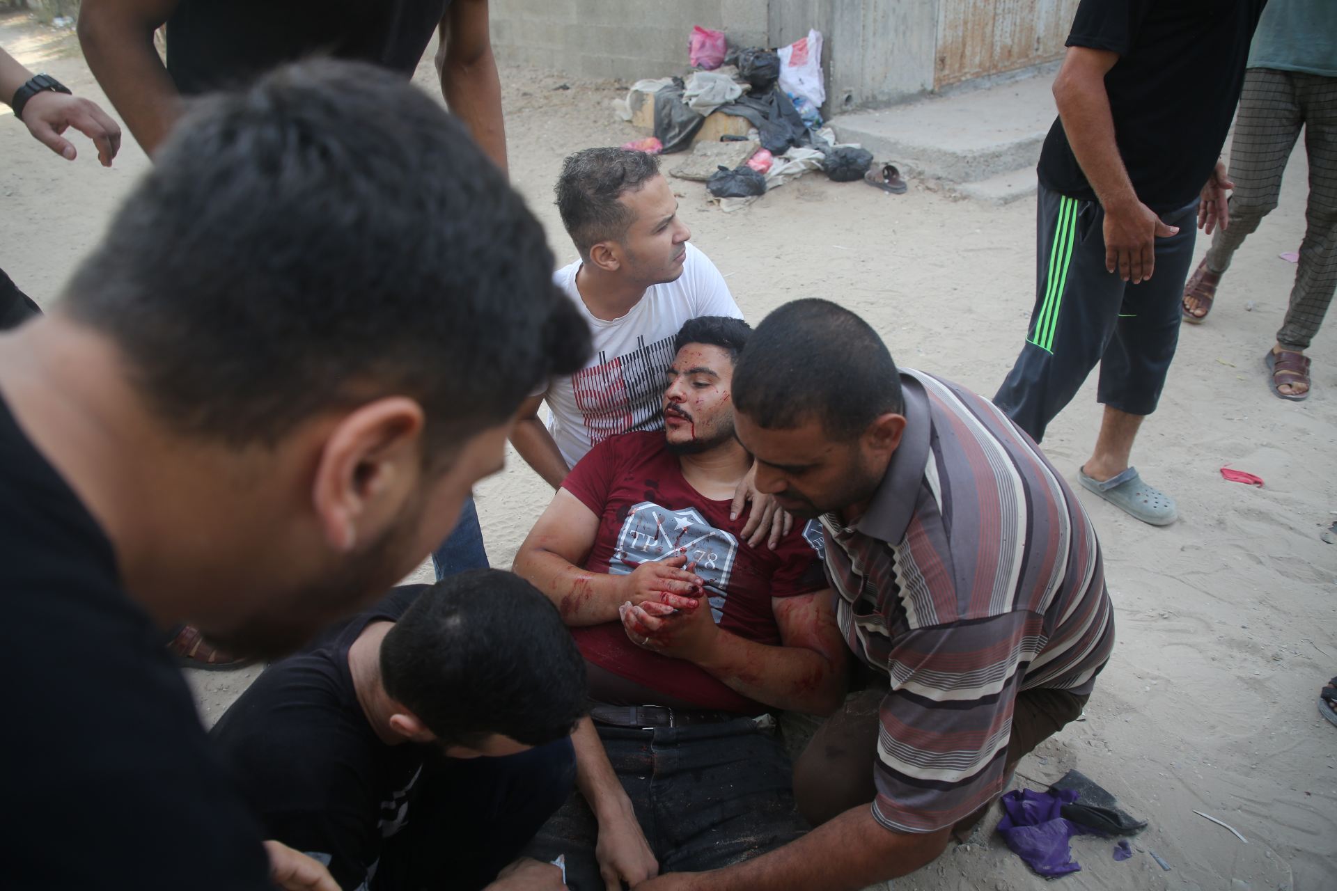 An injured Palestinian is treated for his wounds in the Gaza Strip.