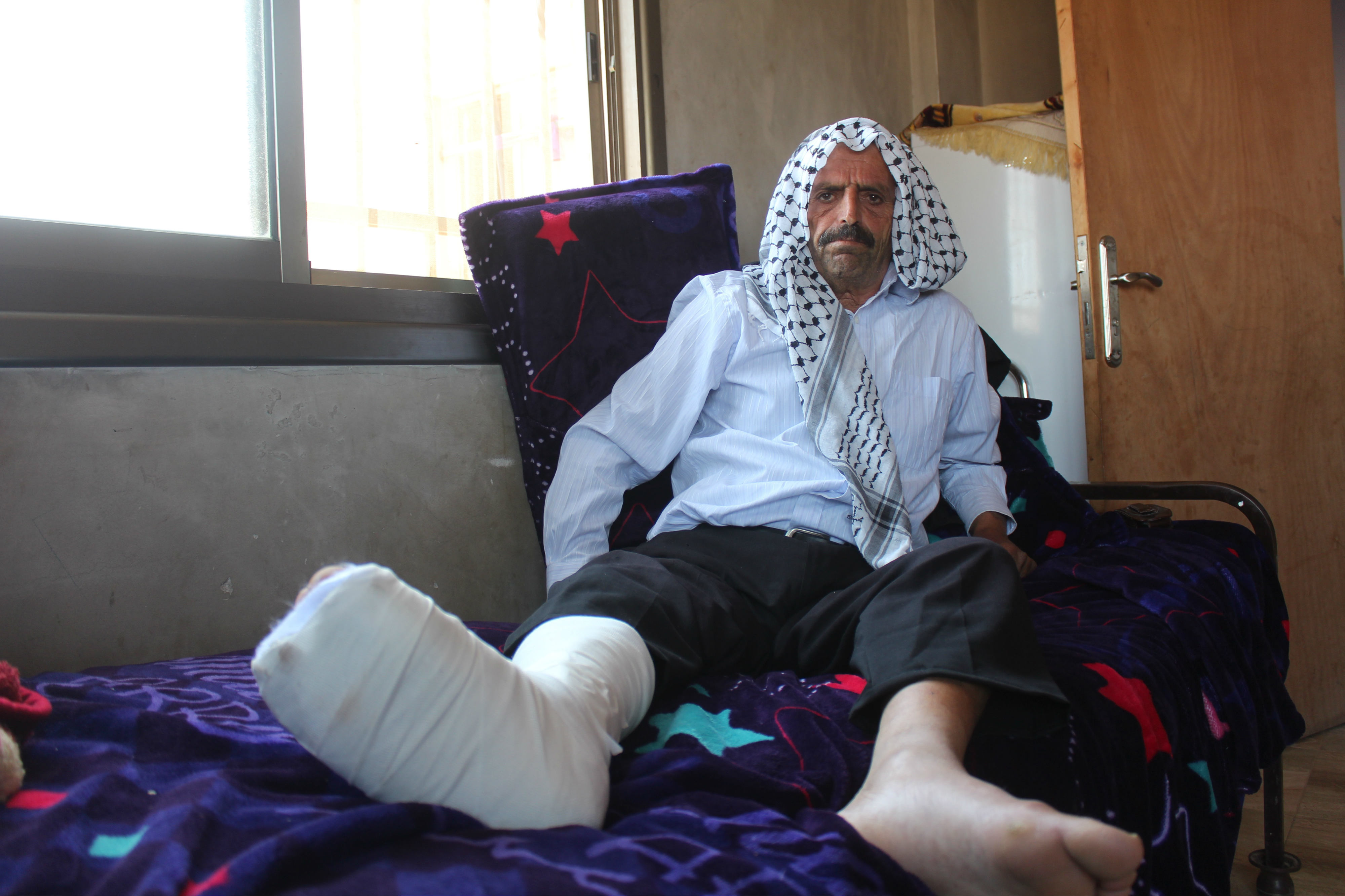 Kamal Abdullah al-Naasan rests his broken foot following a settler attack (MEE/Shatha Hammad)