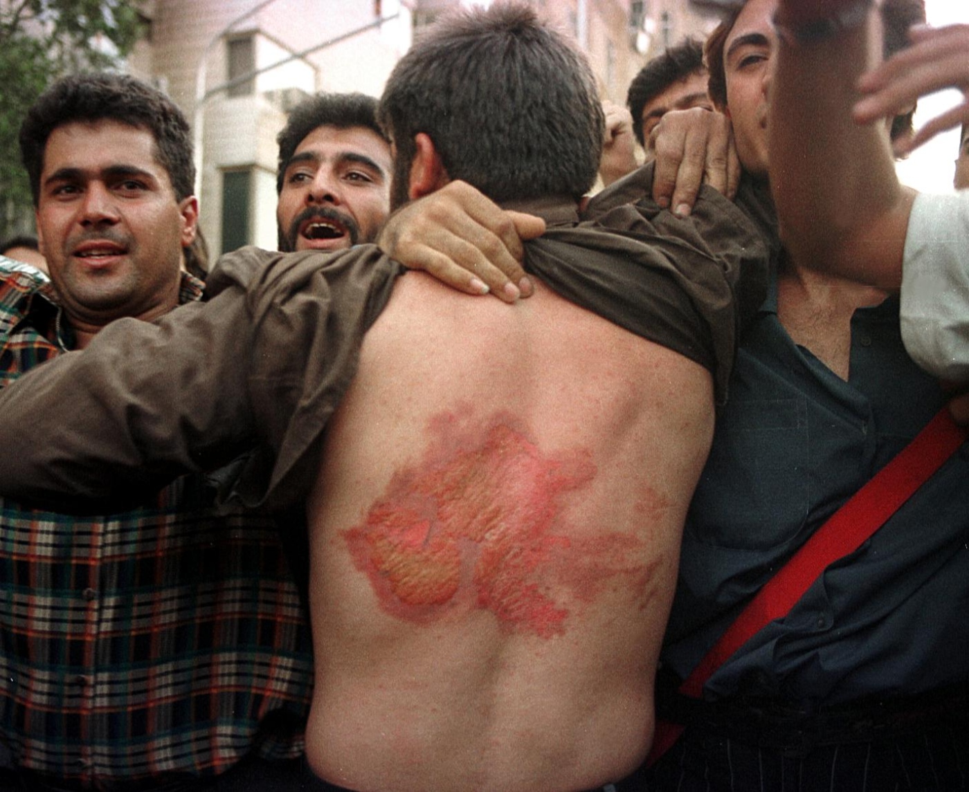 An Iranian student shows wounds he sustained during clashes on 10 July 1999 (AFP)