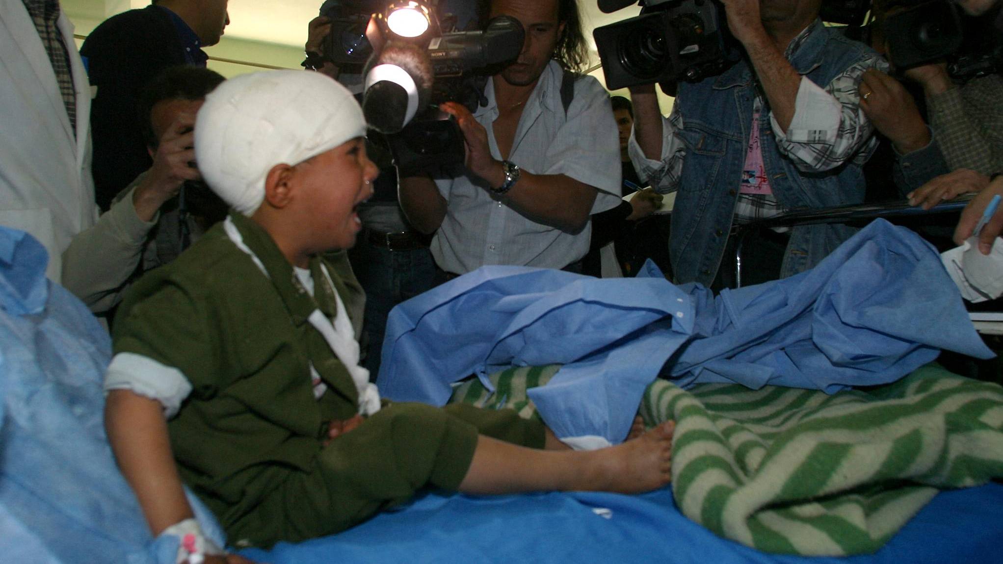 A wounded Iraqi child cries as he is shocked by photographers and cameramen during a tour at al-Yarmouk hospital by the ministry of information in Baghdad 22 March 2003.