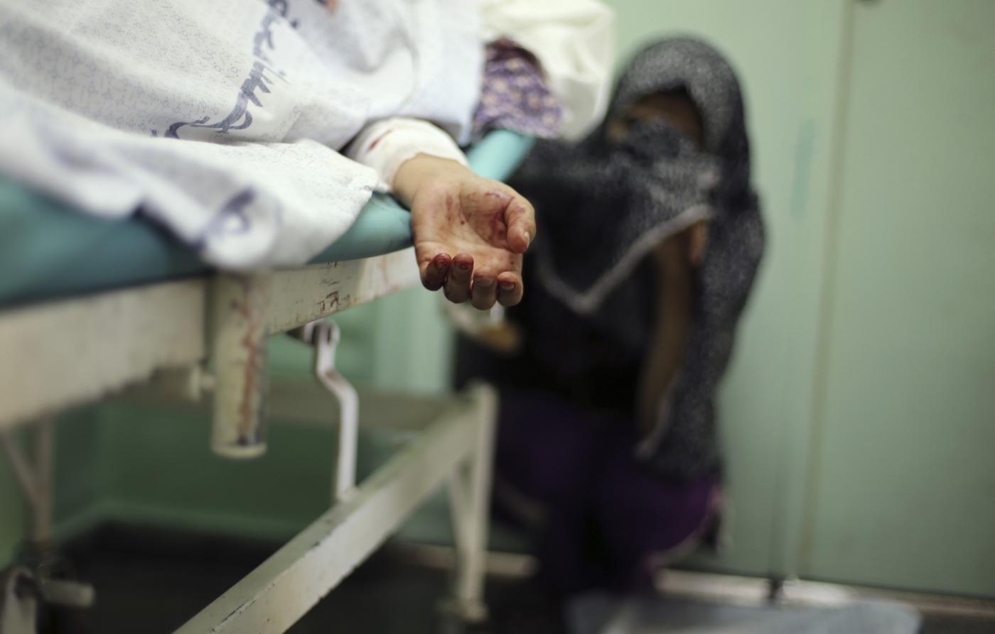 Une Palestinienne blessée dans les bombardements israéliens, sur un lit d’hôpital du Nord de la bande de Gaza, le 29 juillet 2014 (Reuters)