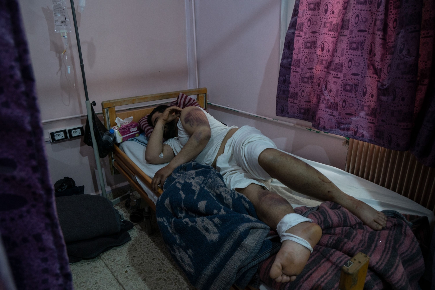 Zakaria Qastal, lying on a treatment bed in Bab Al-Hawa Hospital on March 12, 2023 (MEE/Ahmad Fallaha)