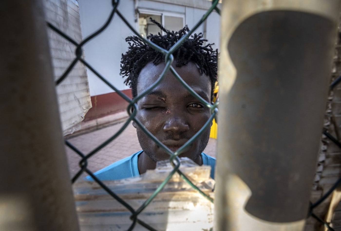 Un migrant soudanais blessé à l’œil est photographié dans le centre temporaire pour migrants et demandeurs d’asile de l’enclave espagnole de Melilla, près de la ville marocaine de Nador, le 25 juin 2022 (AFP/Fadel Senna)