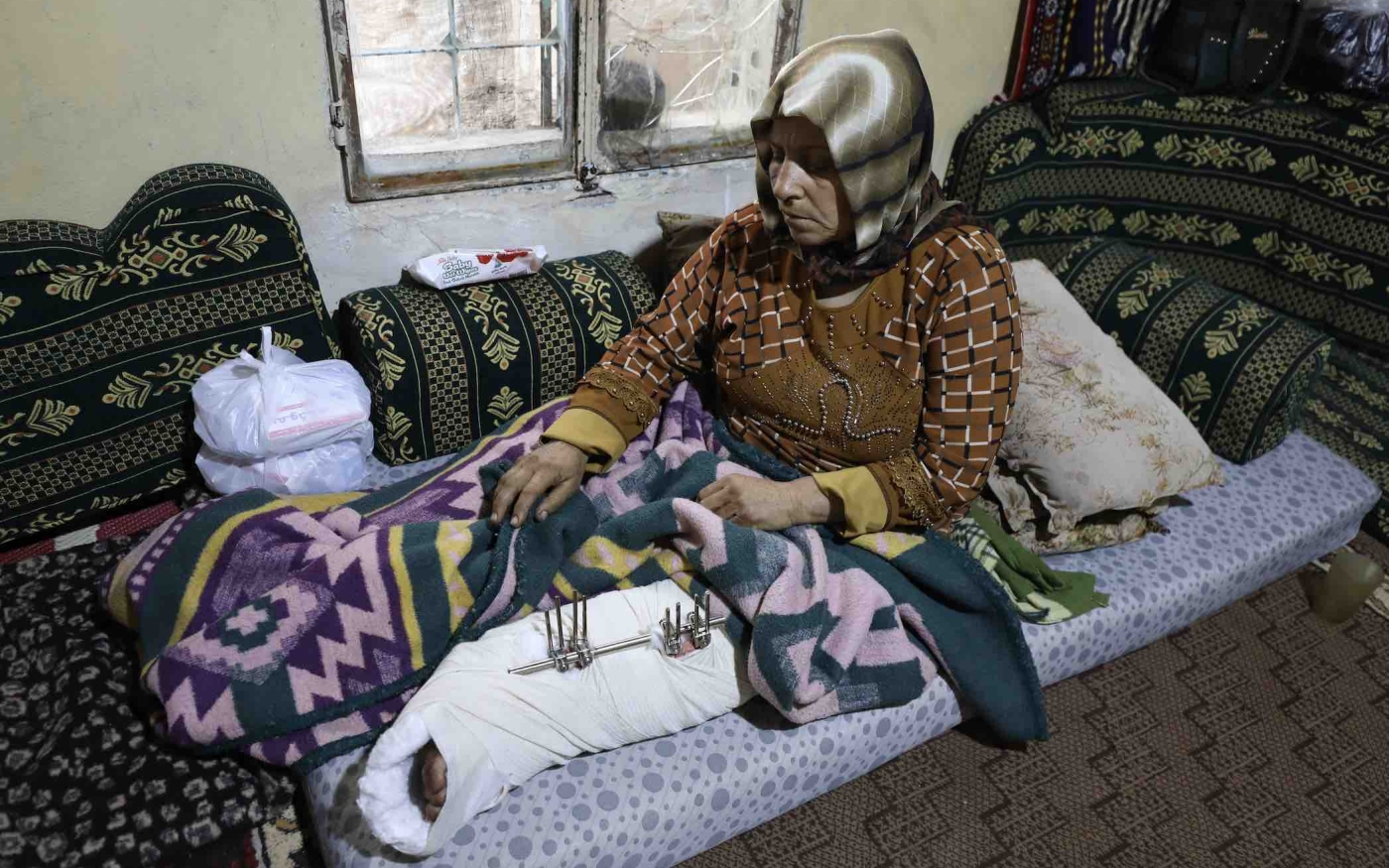 L’épouse d’Ahmed Qasoum repose sa jambe cassée après avoir été blessée lors d’une attaque américaine lancée le 3 décembre près d’Idleb (MEE/Izzeddin Kasim)