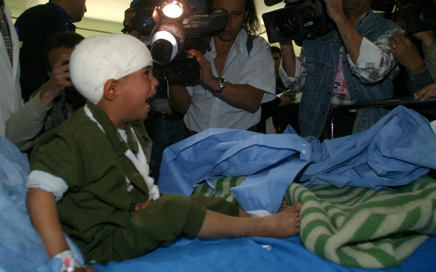 Un enfant irakien blessé pleure devant des photographes et des cameramen lors d’une visite effectuée par le ministère de l’Information à l’hôpital al-Yarmouk de Bagdad, le 22 mars 2003 (AFP)