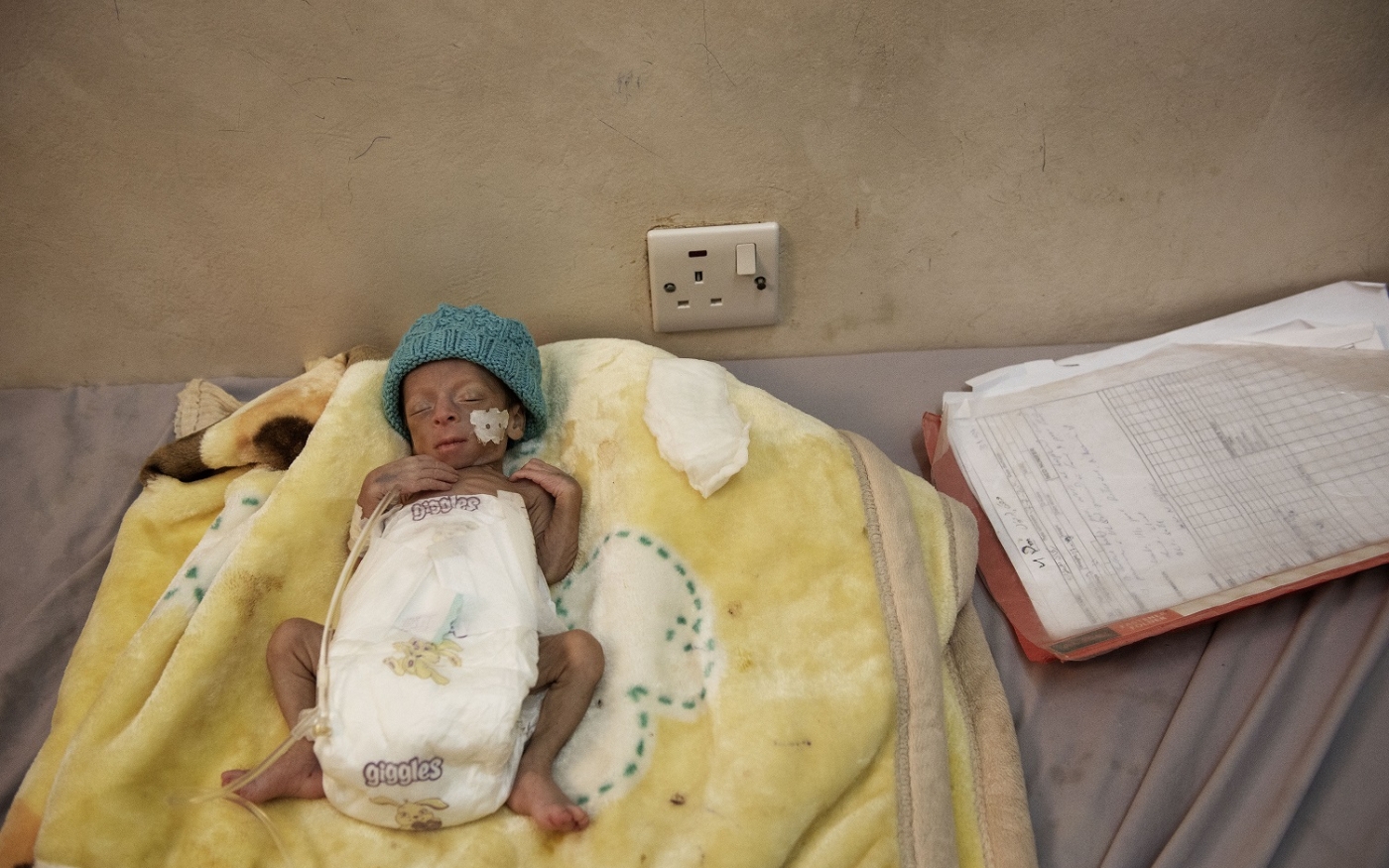 Bébé prématuré dans un hôpital de Médecins sans frontières à Sa’dah (MEE/Alessio Romenzi)
