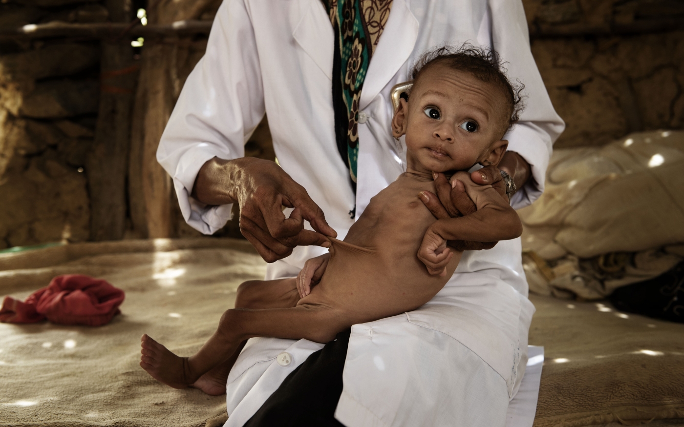 Une infirmière examine un enfant malade dans la campagne d’Abs, dans le nord-ouest du Yémen (MEE/Alessio Romenzi)