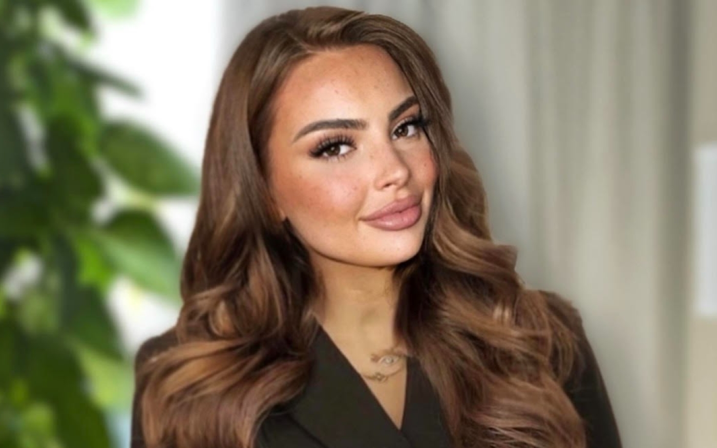 Selena Marianova, 22 ans, a subi une rhinoplastie à Istanbul en 2019 et a partagé son expérience en ligne (avec son aimable autorisation)