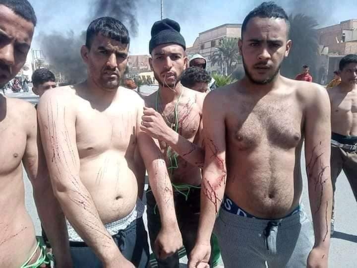 Jeunes chômeurs de Ouargla qui se sont tailladés le corps, l’un d’eux s’est cousu la bouche, ce mardi 23 mars 2021 (Facebook)