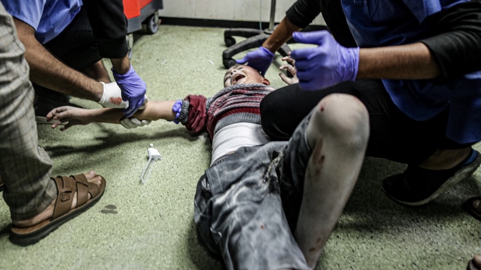 A child injured following Israeli bombardment grimaces as he receives medical care at Nasser hospital in Khan Younis, southern Gaza, on 17 December 2023 (AFP)