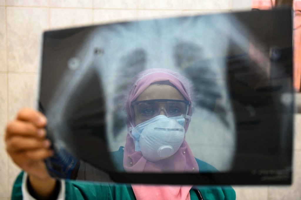A doctor looks at a patient's lung X-ray at a Cairo hospital, 19 April 2020 (AFP)