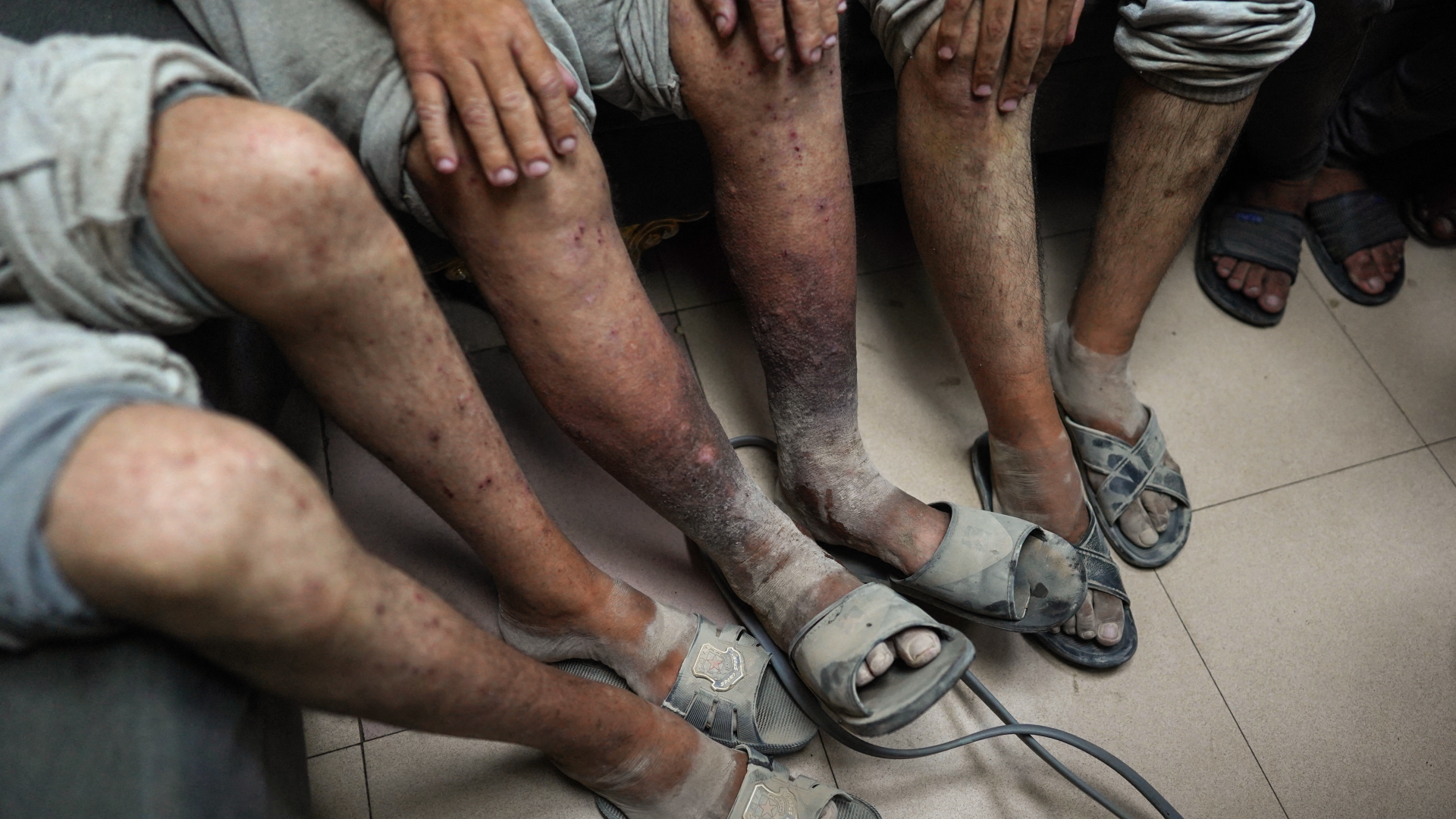 Released Palestinian detainees attend a medical check-up in Gaza on 1 July. AFP/ Basher Taleb.