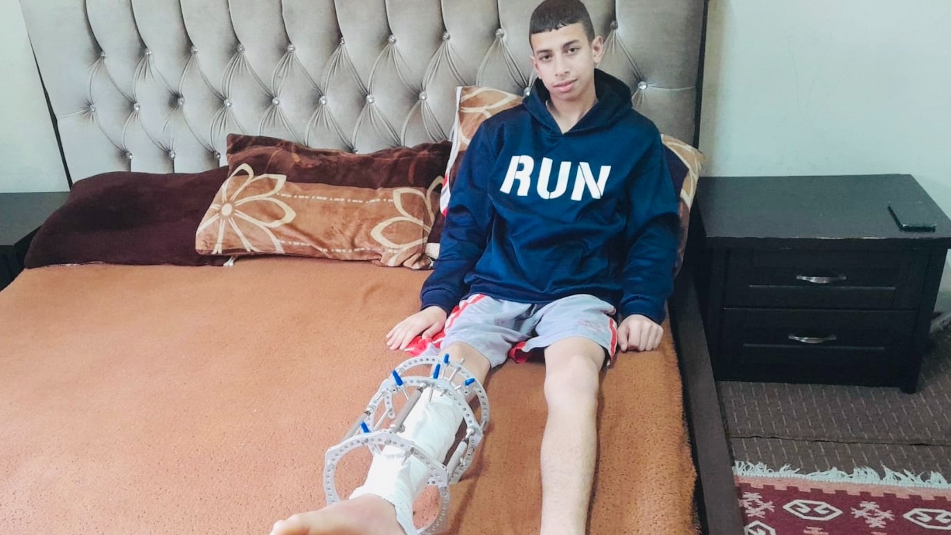 Palestinian child, Amir Al-Biss, suffers two bullet wounds in his right leg since he was shot by Israeli soldiers north of Hebron on 4 March (MEE)