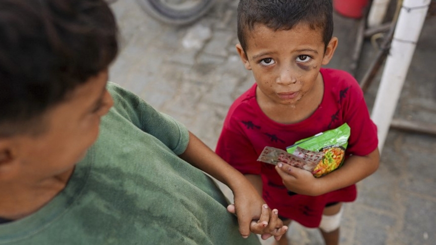 An injured child holds food in Khan Younis, Gaza, on 15 August 2024 (Bashar Taleb/AFP)