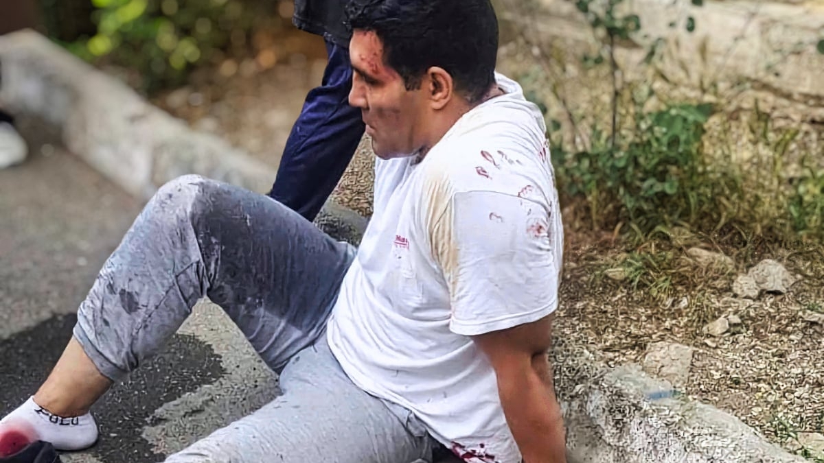 Reza Moradkhani and his wife Maria Arefi said the religious morality police attacked them in April while they were in a public park with their daughter, shooting Moradkhani in the leg (Twitter)