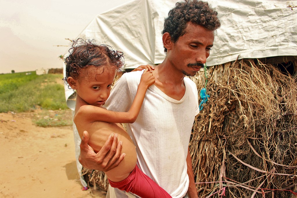 A malnutritioned child is carried by her father in northern Yemen on 23 September (AFP)