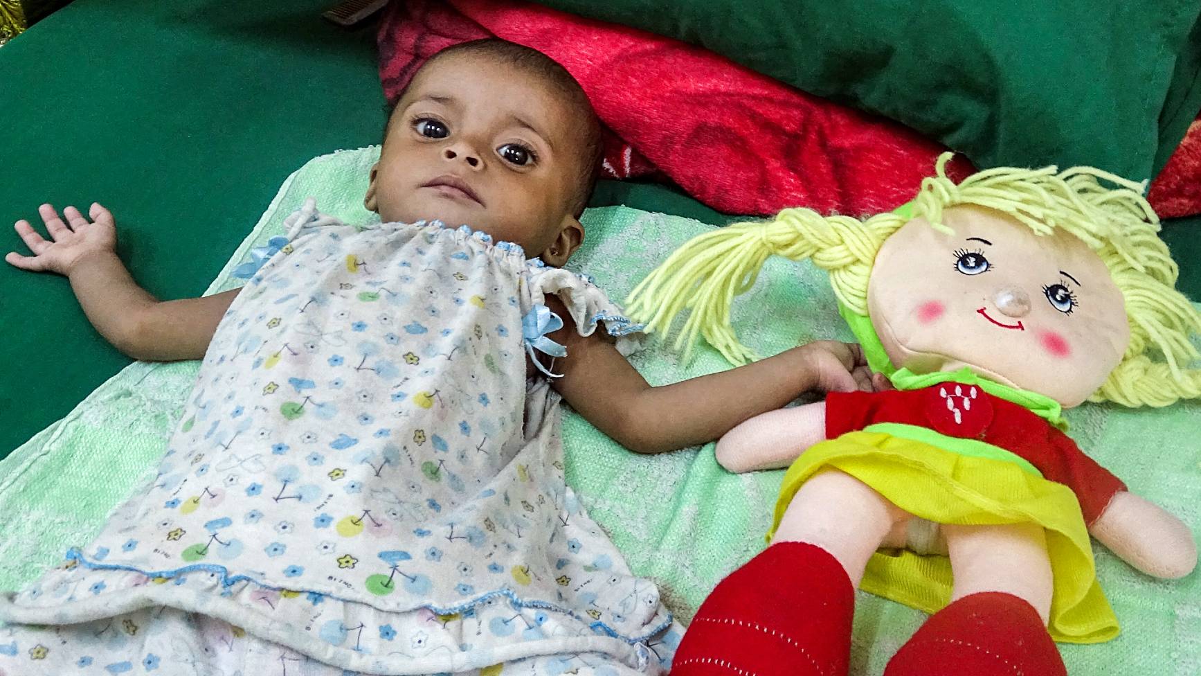 A malnourished child lies on a bed next to a doll at a malnutrition treatment centre in Yemen's war-ravaged western province of Hodeida on August 18, 2021.