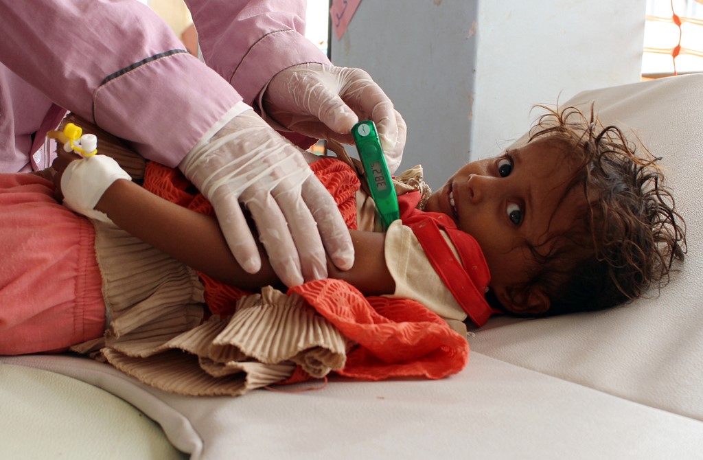 A Yemeni child suspected of being infected with cholera is checked by Doctors Without Borders (MSF) in a makeshift hospital in Hajjah in July 2017 (AFP)